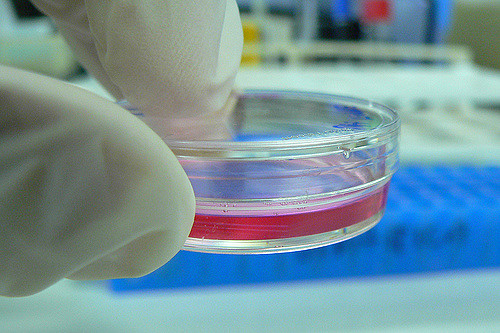 Petri Dish